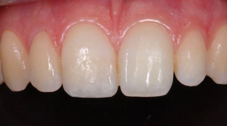 ricostruzioni estetiche